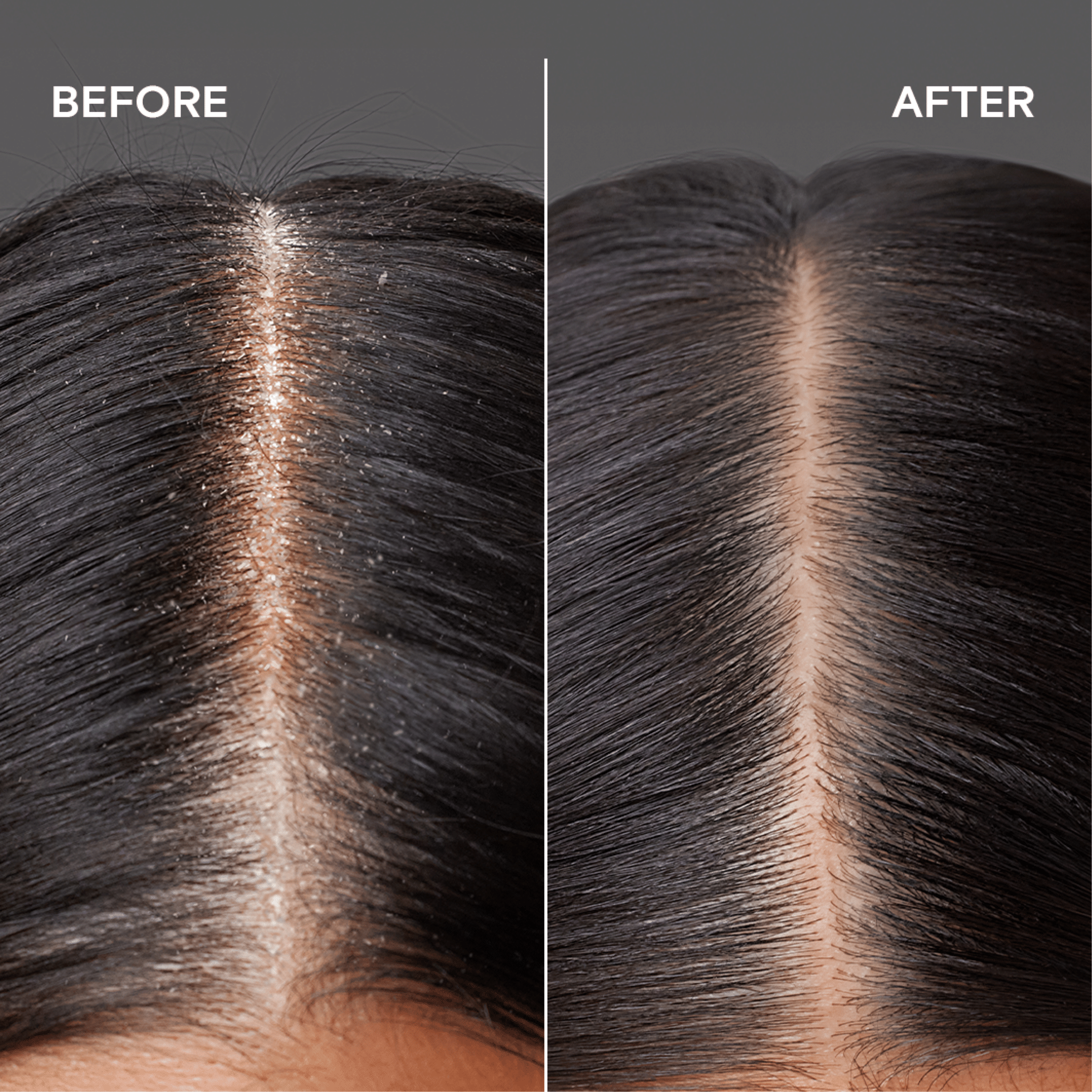 Joico Scalp Vitality Replenishing Essence 100ml