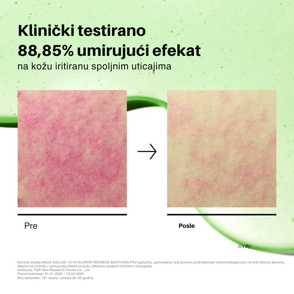 Azelaicacid 10 Hyaluron Redness Soothing Pad 230ml 90ea