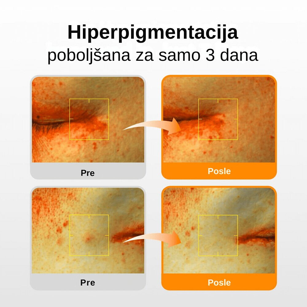 Glutathiosome Dark Spot Serum Vita Drop 50ml