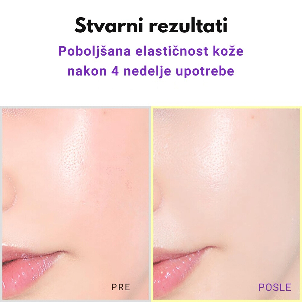 Hyper Retinol Ex 1.0 Serum 20ml