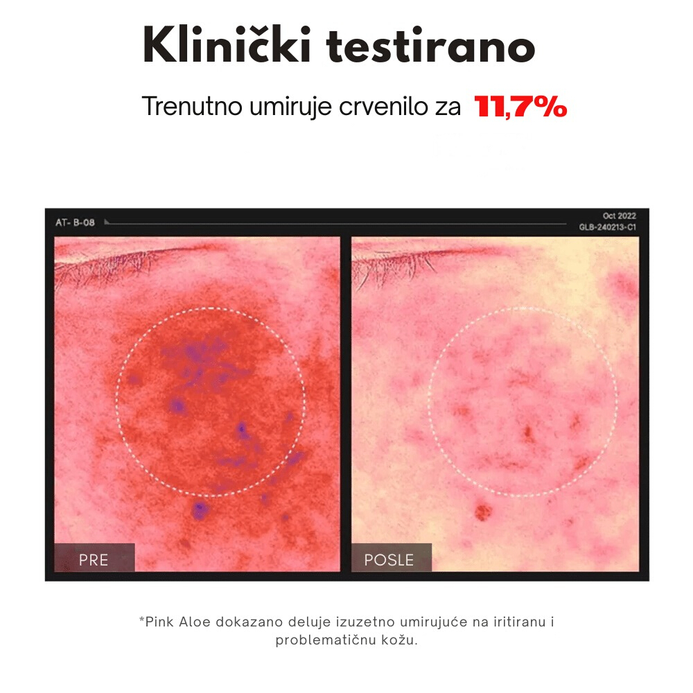 Pink Aloe Pack Cleanser 120g